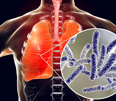 Legionella pneumophila close-up and a skeleton