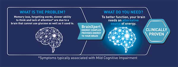 Memory loss chart BrainXperts