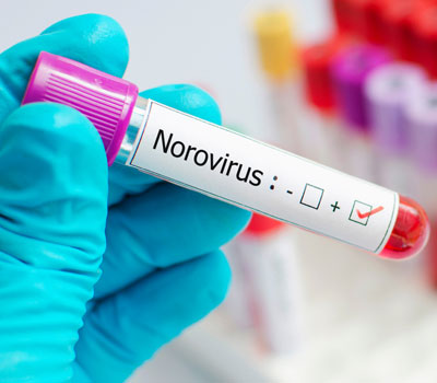 norovirus outbreak in test tube