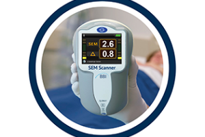 The BBI SEM scanner, which detects pressure ulcers at an early stage